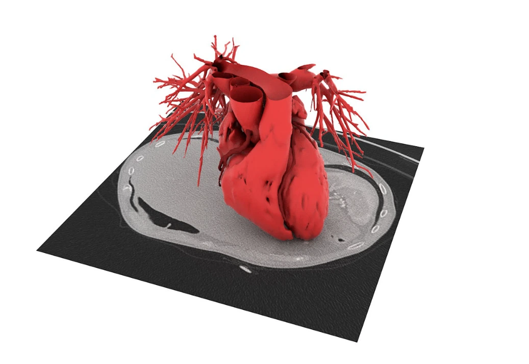 Artiness · Modello cardiovascolare